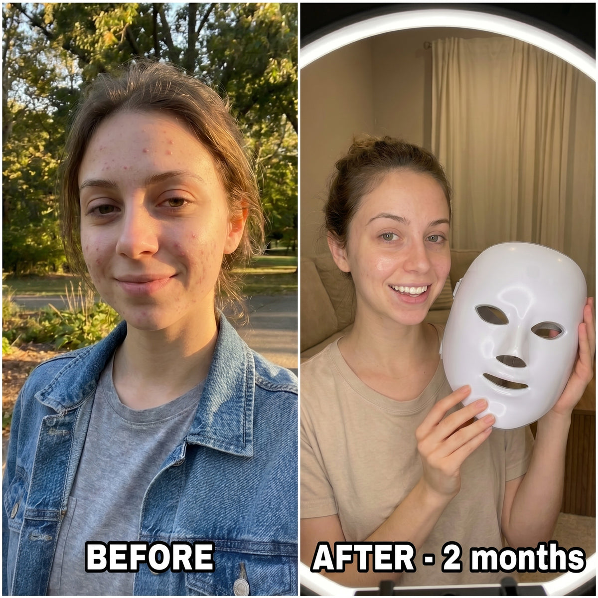 SkinGlow LED Face Mask — 7-Color Light Therap